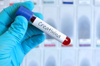 O QUE SÃO CREATININA E UREIA? – Exame para avaliação dos rins