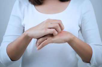 DERMATITIS ATÓPICA – Síntomas, Causas y Tratamiento