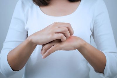 DERMATITIS ATÓPICA – Síntomas, Causas y Tratamiento