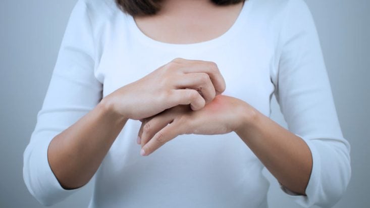 Dermatitis atópica: qué es, causas, síntomas y tratamiento