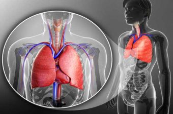 DERRAME PLEURAL – Síntomas, causas y tratamiento