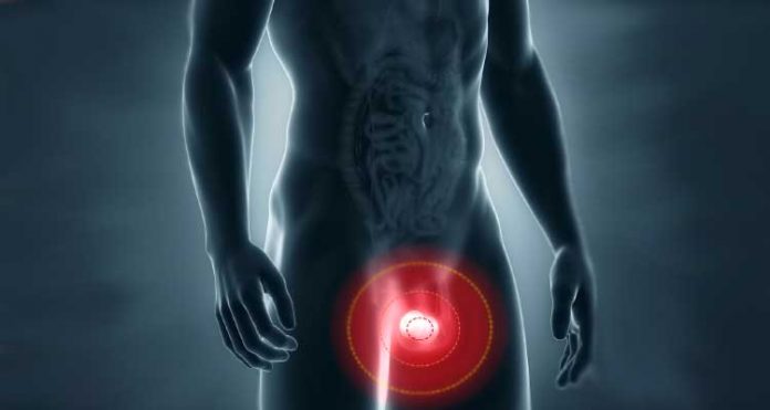 dor-testiculos Dor nos testículos