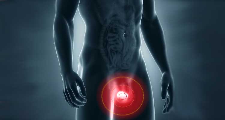 Dolor en los testículos: causas y tratamiento