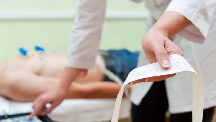 ecg-ilustracao ECG