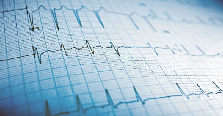 eletrocardiograma