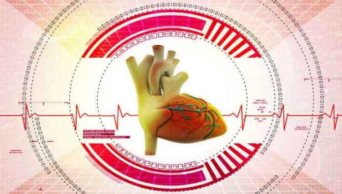 endocardite-ilustracao endocarditis