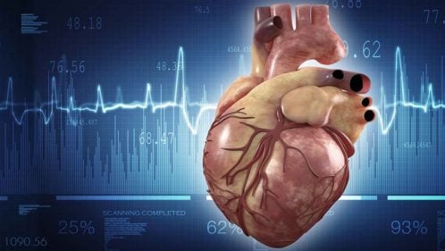 Endocarditis: qué es, síntoma, tratamiento y profilaxis