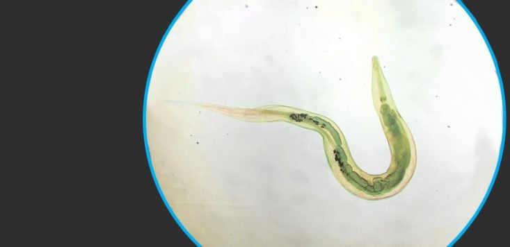 Oxiuriasis (enterobiasis): qué es, síntomas y tratamiento