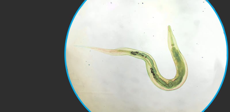 Larvas de oxyuris vermicularis, Helmintox tunisie - Enterobius vermicularis larva