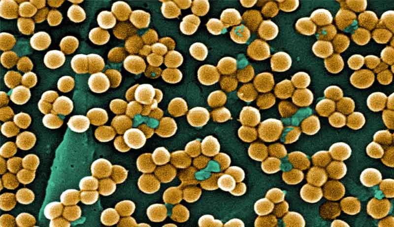 Staphylococcus aureus