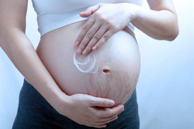 ESTRIAS NA GRAVIDEZ – Causas, tratamento e prevenção