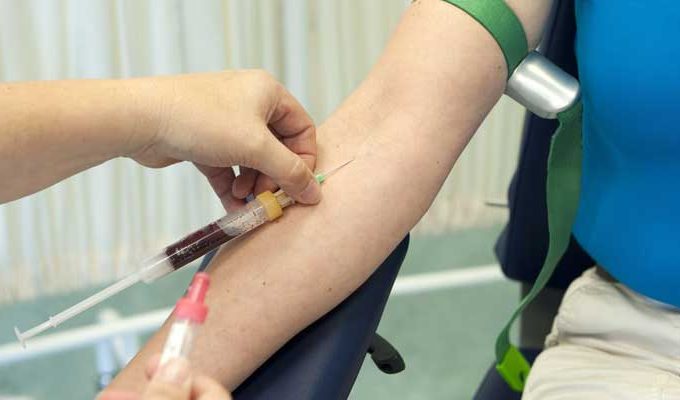 biopsia da prostata sangue na urinal