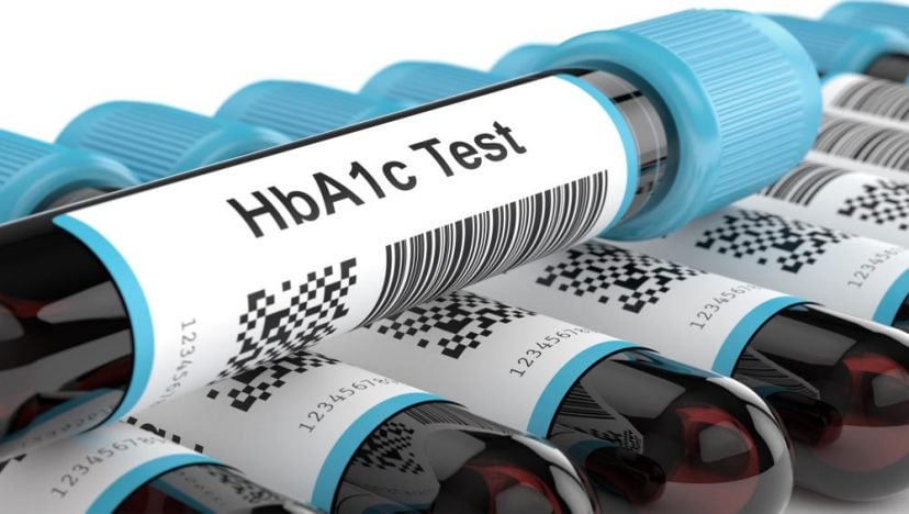 hemoglobina glicada (HbA1c) | O que é e valores normais