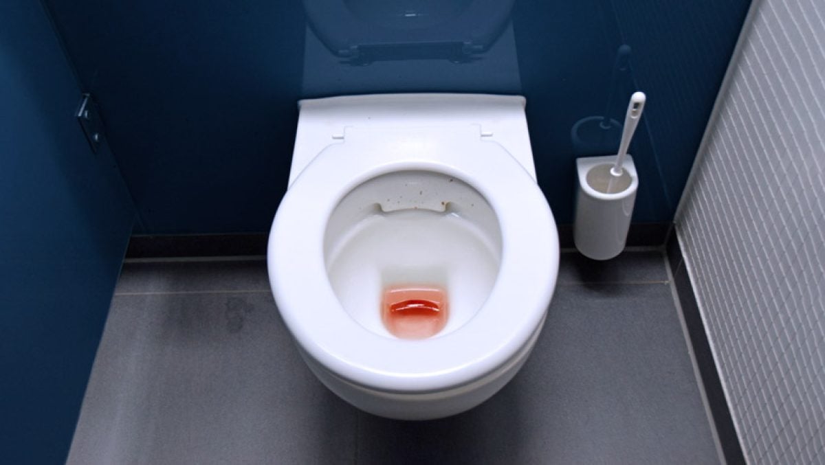 É normal expelir coágulos de sangue durante a menstruação