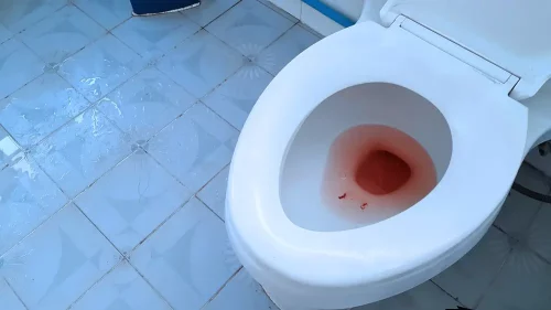 É normal expelir coágulos de sangue durante a menstruação