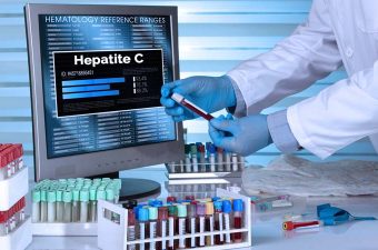 HEPATITE C – Sintomas, transmissão e tratamento