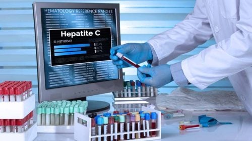 Hepatitis C: síntomas, transmisión y tratamiento