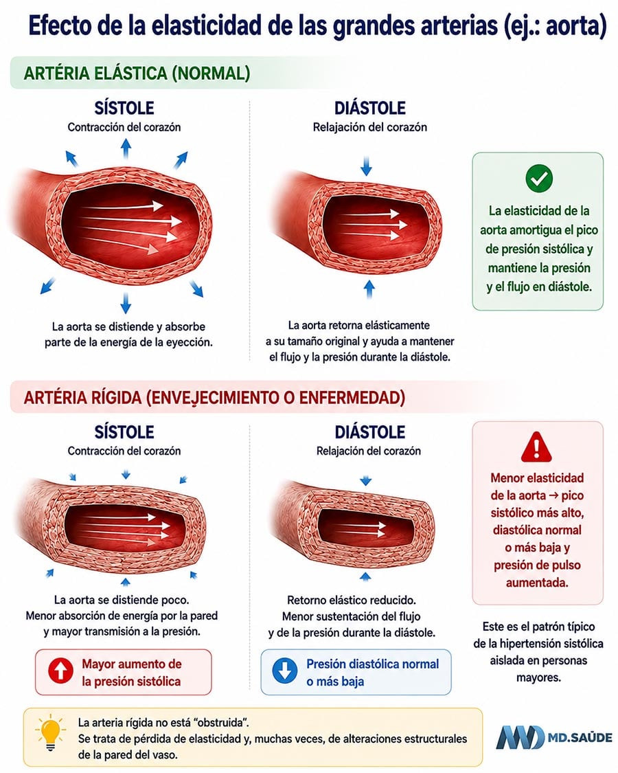 Hipertensión sistólica aislada