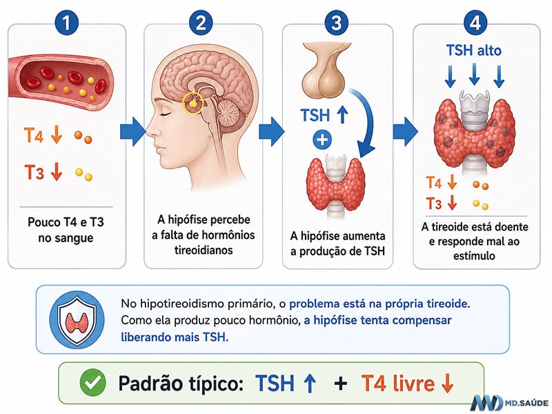 Hipotireoidismo primário