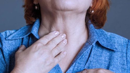 Subclinical Hypothyroidism