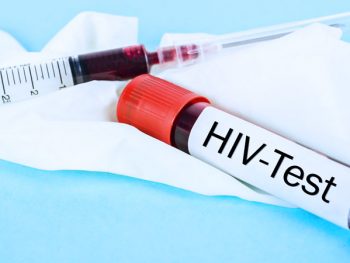 HIV agudo