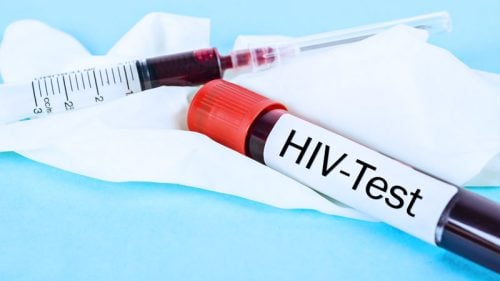 Lavoisier testes rápidos, O Lavoisier oferece testes rápidos de HIV e BHCG  com maior segurança e rapidez. Você já sai com o resultado na mão e não  perde tempo. Confira quais