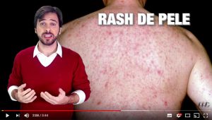 Sintomas HIV - vídeo