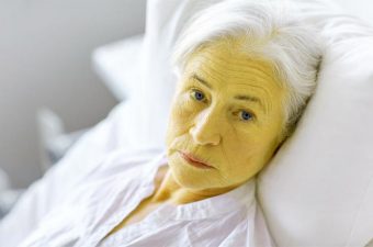 ICTERICIA (piel amarillenta) – Causas, síntomas y tratamiento