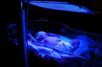 ICTERICIA NEONATAL – Causas y Tratamiento