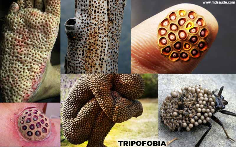 Tripofobia [com imagens]: o que é, sintomas e tratamento | MD.Saúde