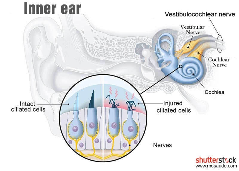 pin Peer Springplank Tinnitus (ear ringing): Causes, Types and Treatment