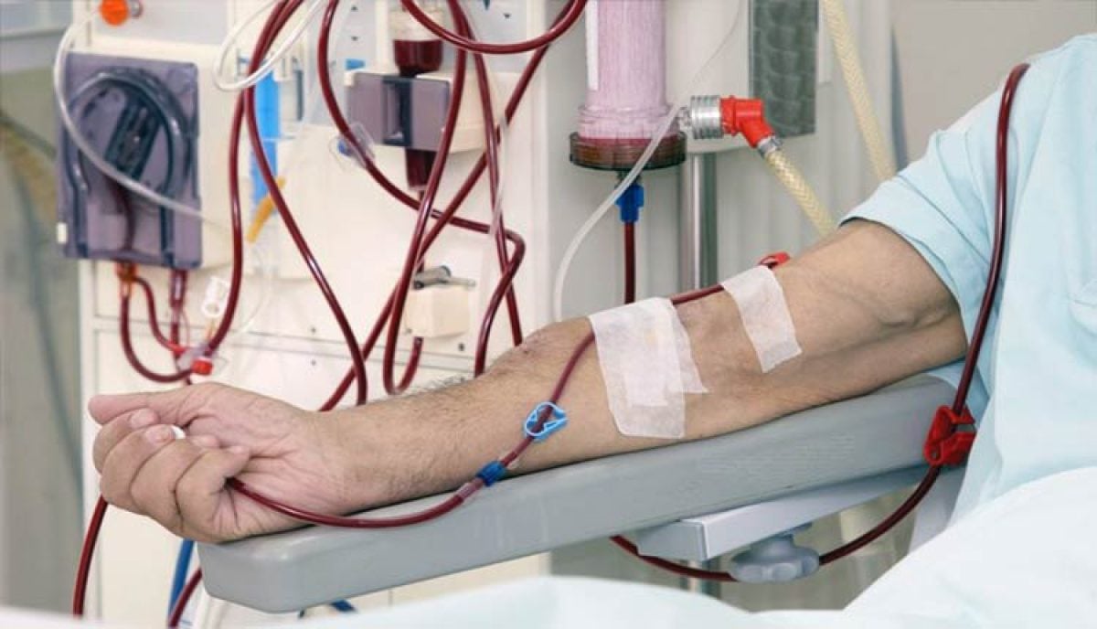 INSUFICI&Ecirc;NCIA RENAL AGUDA | MD.Sa&uacute;de