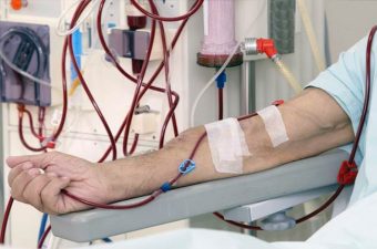 INSUFICIÊNCIA RENAL AGUDA – Causas, sintomas e tratamento