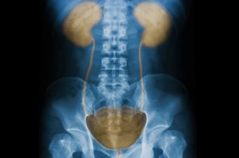 22 DICAS PARA EVITAR A INFECÇÃO URINÁRIA