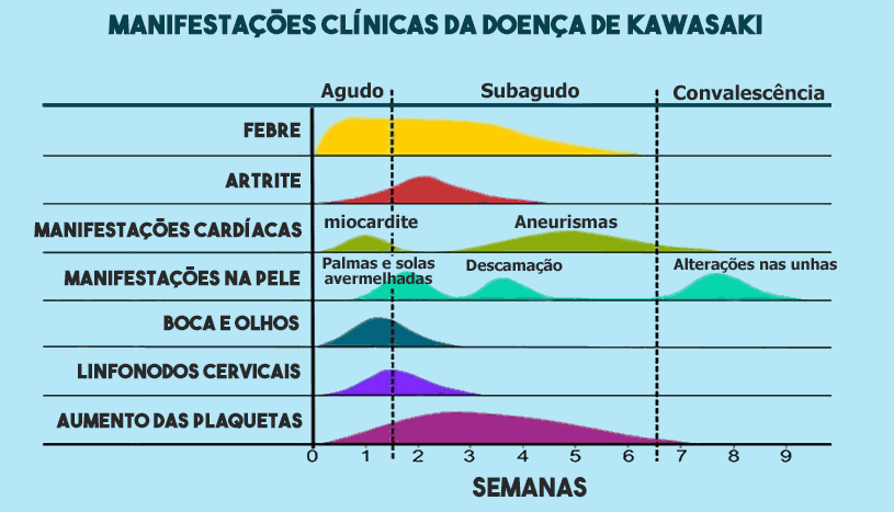 Sintomas da doença de Kawasaki