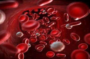 7 SÍNTOMAS DE LA LEUCEMIA