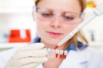 LINFOMA – Tipos, síntomas y tratamiento