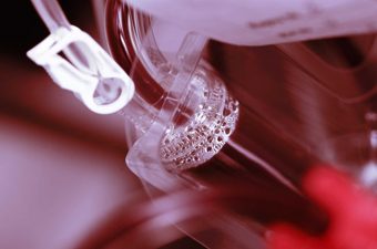 MIELODISPLASIA – Causas, síntomas y tratamiento