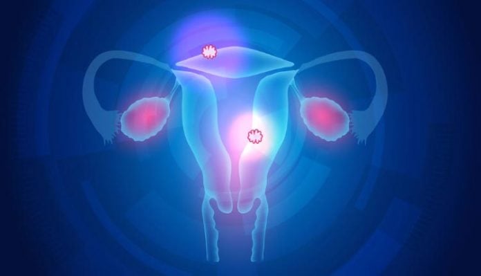 Como tomar furosemida para adelgazar