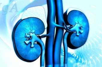 NEFROPATÍA POR IgA (enfermedad de Berger) – Síntomas y tratamiento