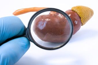 glomerulonefritis membranosa