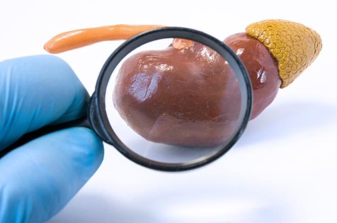 Hematuria por clamidia Hematuria por clamidia