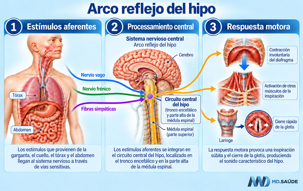 Arco reflejo del hipo