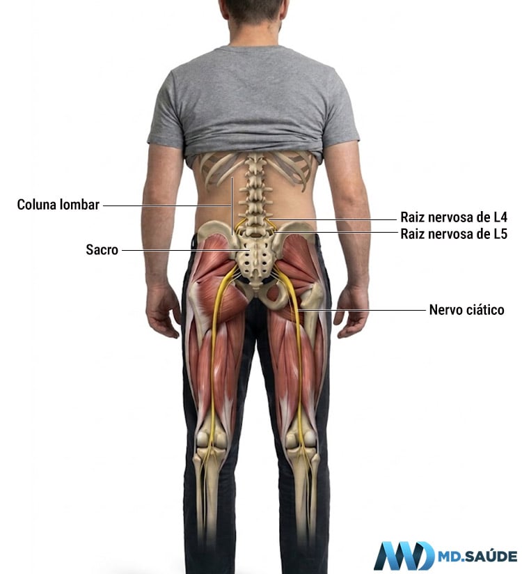 Vista posterior do corpo humano mostrando a coluna lombar, o sacro, as raízes nervosas L4 e L5 e o trajeto dos nervos ciáticos pelos glúteos e pela parte posterior das pernas.