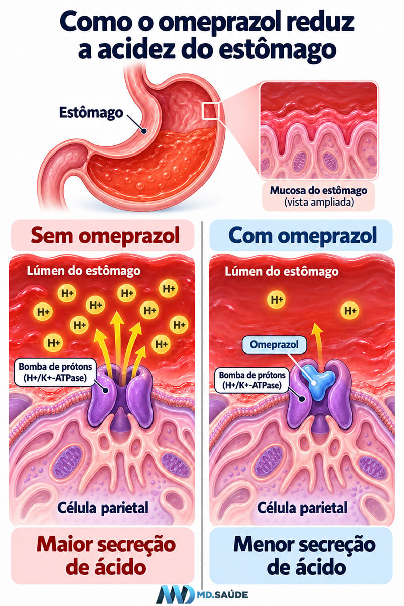 Ilustração mostrando como o omeprazol bloqueia a bomba de prótons das células parietais e reduz a produção de ácido no estômago.