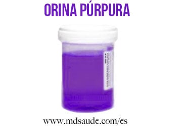 Orina púrpura