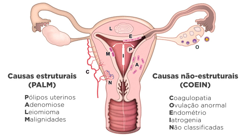 Sangramento vaginal fora do período menstrual: o que pode ser e causas