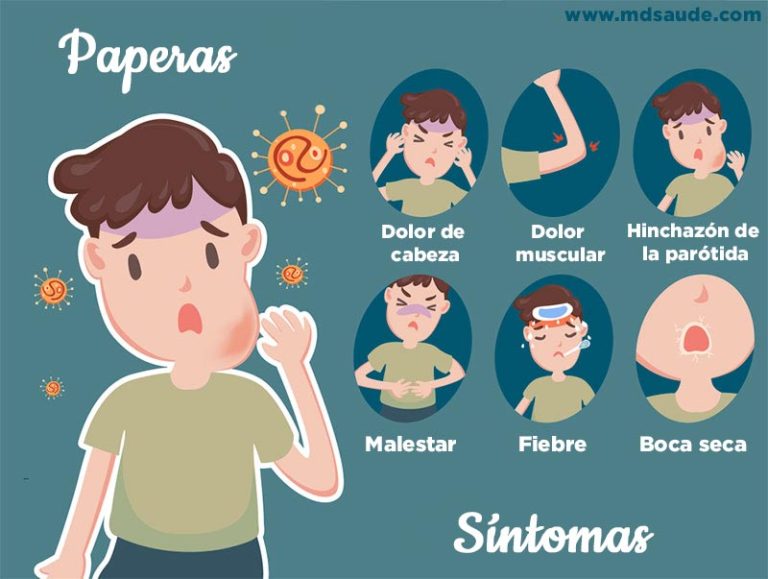 Paperas síntomas, transmisión y tratamiento MD.Saúde