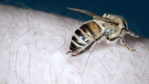 ¿Qué hacer en caso de picadura de abeja o avispa?