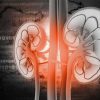PIELONEFRITIS – Causas, Síntomas y Tratamiento